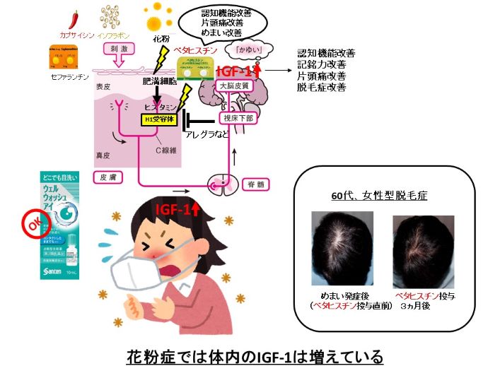 円形脱毛症　病院